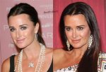 Has Kyle Richards Had Plastic Surgery? What the 'Rhobh' Star Has Said |