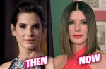 Sandra Bullock's Plastic Surgery Journey Explored